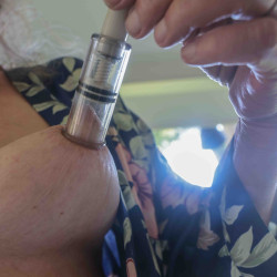 Pic #1 nipple assistance