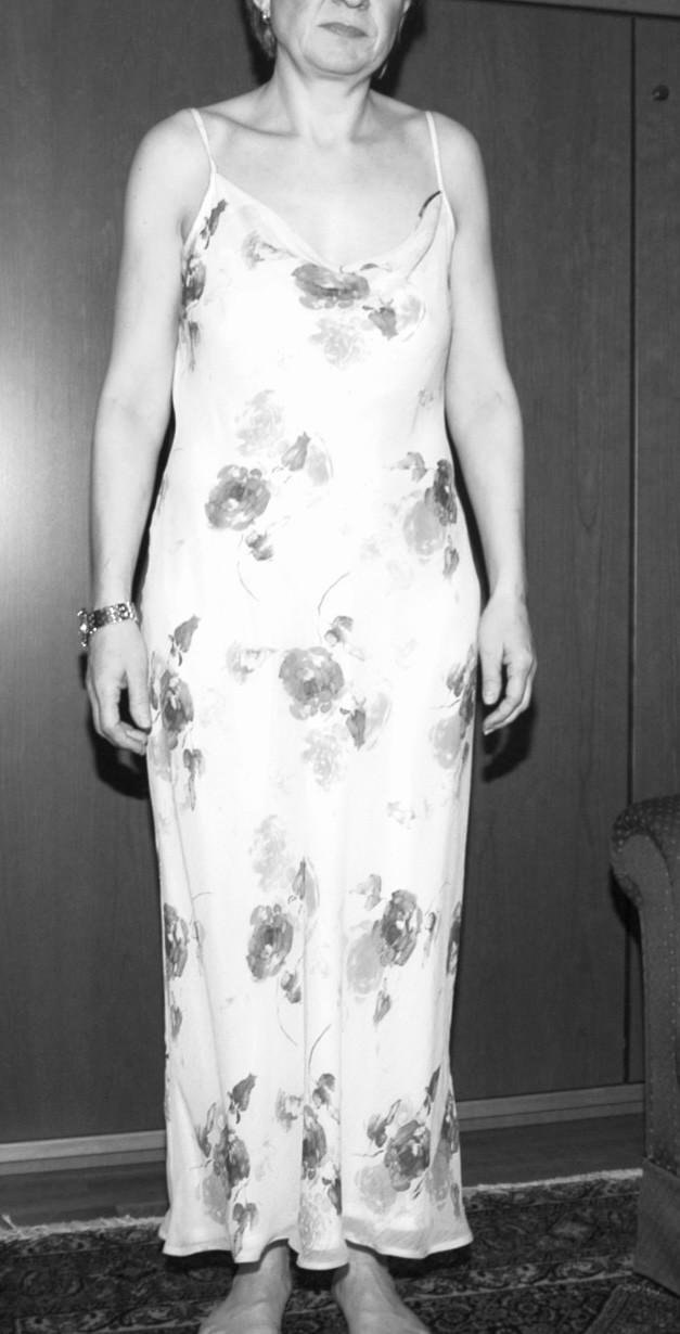 Pic #1Schwarz weiss - Amateur, Ass, Brunette, Girls Stripping, Hanging Tits, Hard Nipples, Homemade Amateur, Legs Spread Wide Open, Natural Tits, Nude Amateurs, Nude Wives, Pussy, Pussy Hair, Small Tits