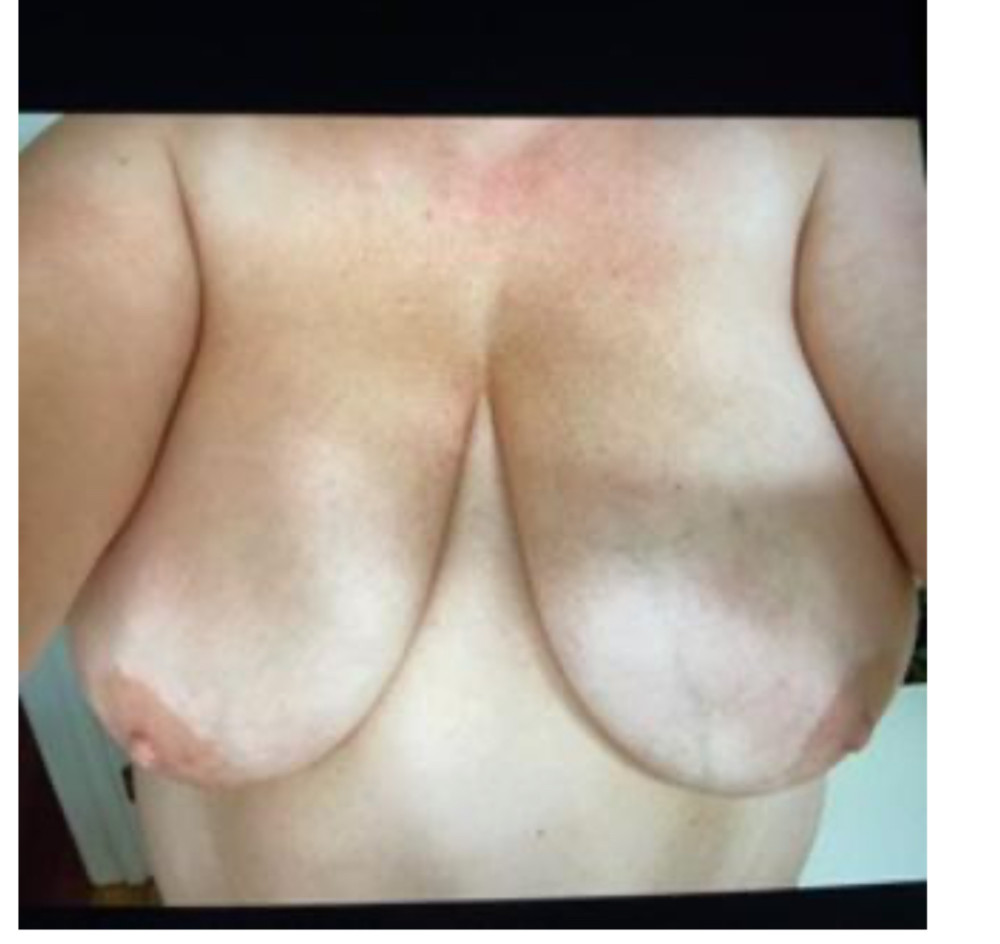 Pic #1 Very large tits of my wife - Big tit wife