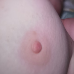 Pic #1 Nipples , areola