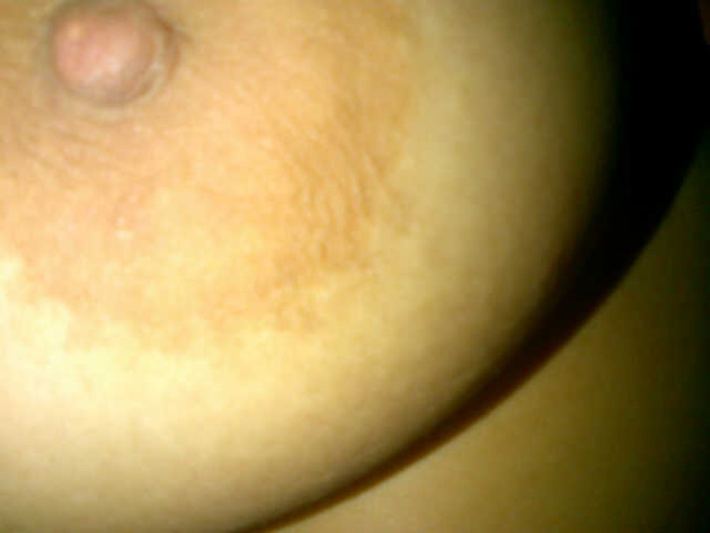 Pic #1 Dientes