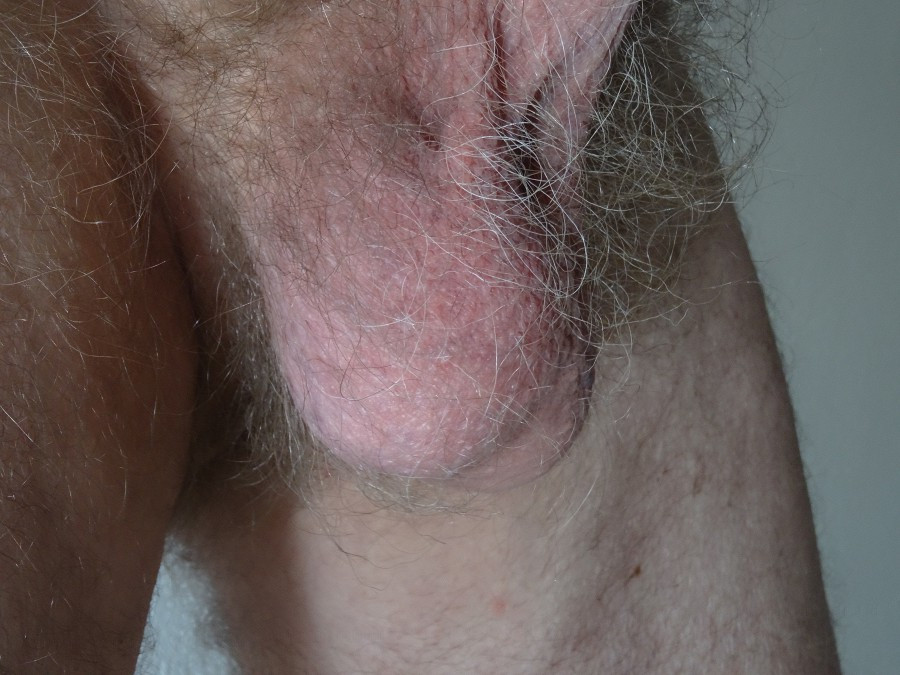 Pic #1 My ass - Andrij