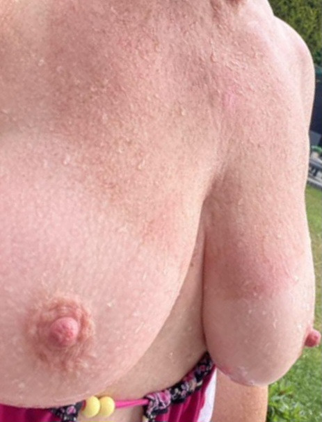 Pic #1 Large tits of my wife - Tilfie