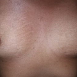Pic #1 La morena 28