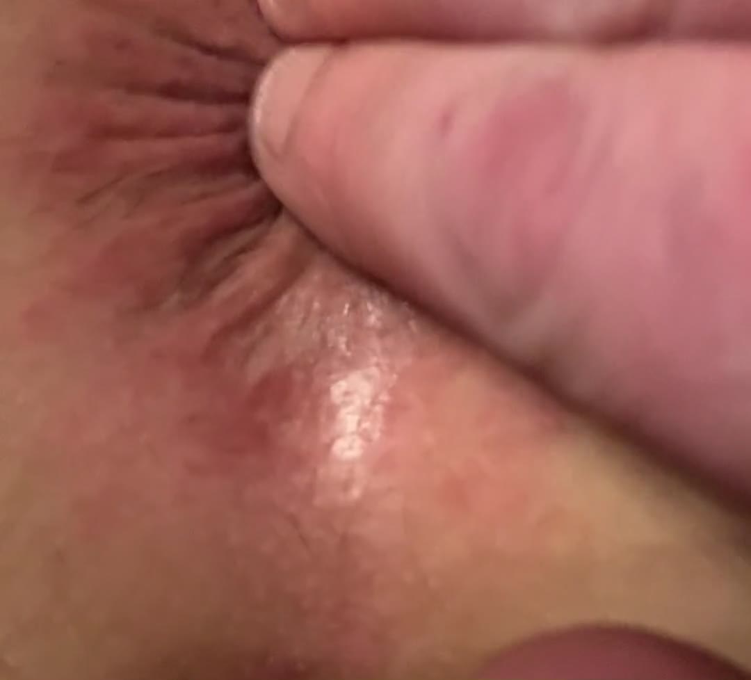 Pic #1anal play