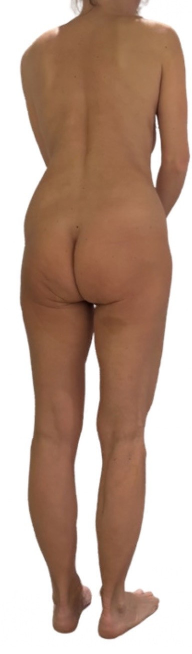 Pic #1 My wife's ass - Rl125