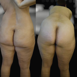 My ass - JustEmma