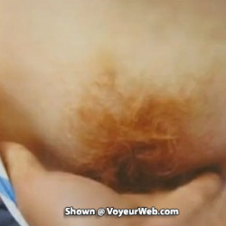 Hairy red bush redhead