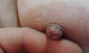 Pic #1My Donna's tits and nipples