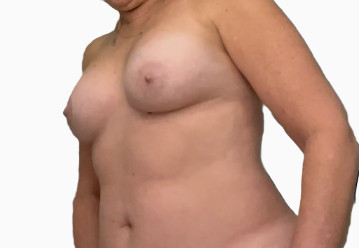 Pic #1Nudes