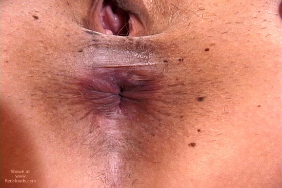 Pic #1Alanna'S Butthole