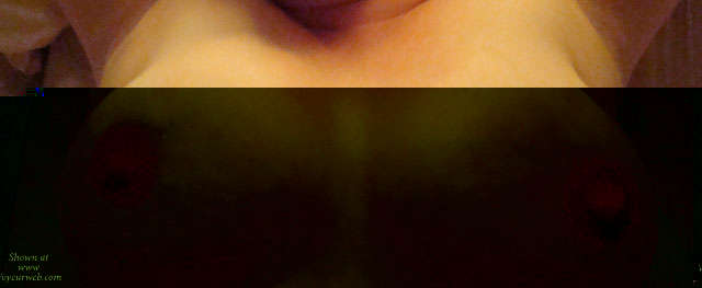 Pic #1 Nipple Suction