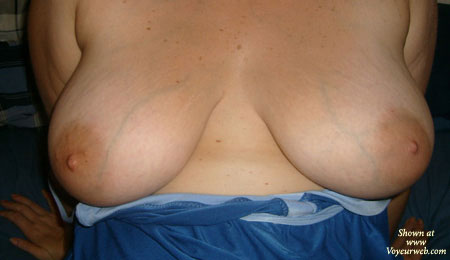 Pic #1 Huge Tits